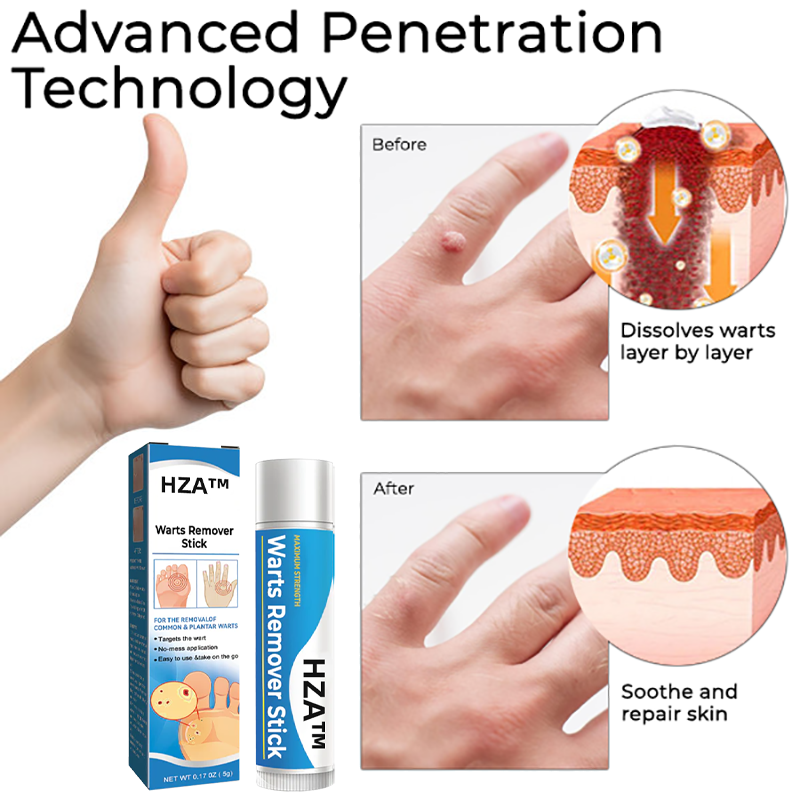 HZA ® Warts Remover Stick