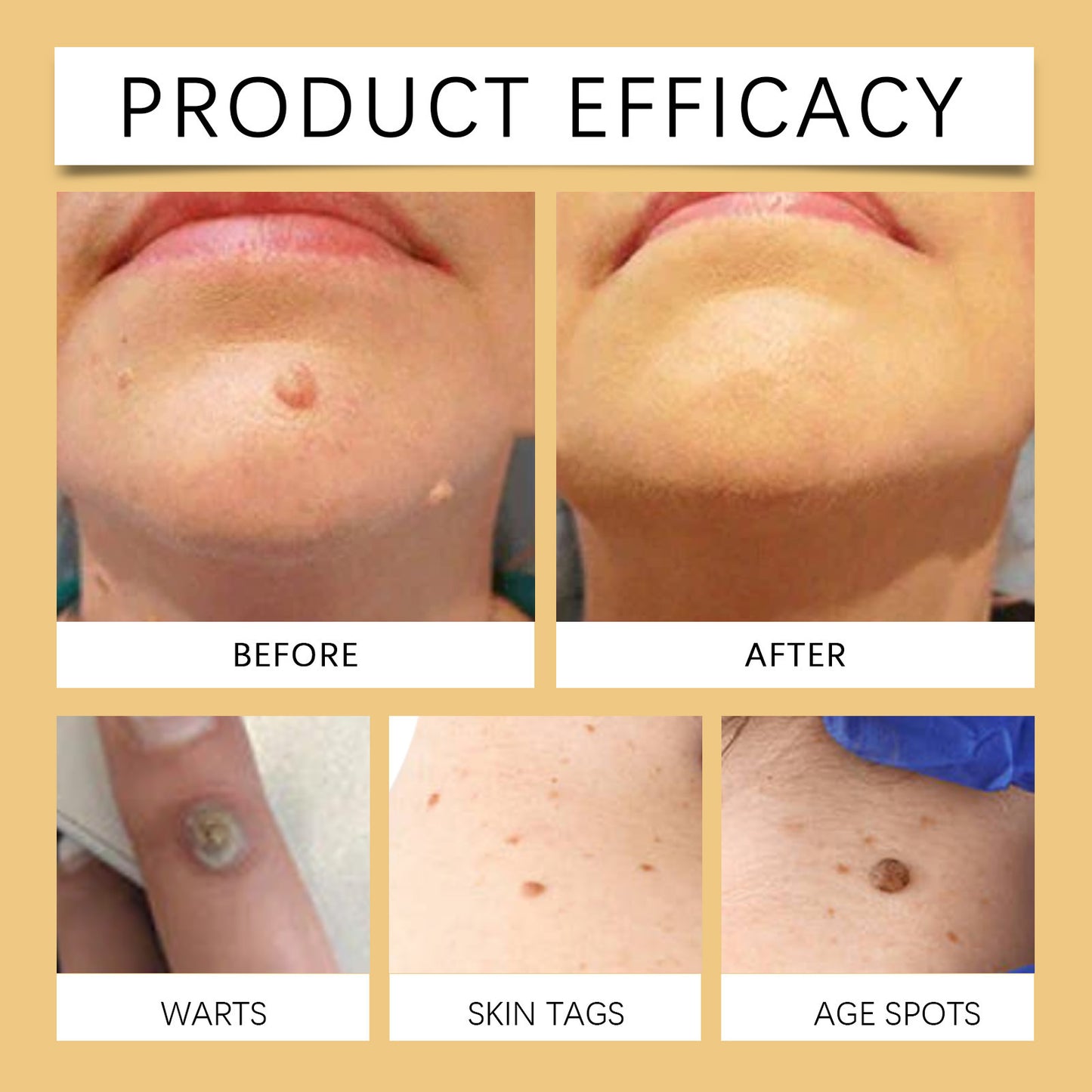 🐝BBOJI™ TagRecede Apitoxin Mole Removal Cream