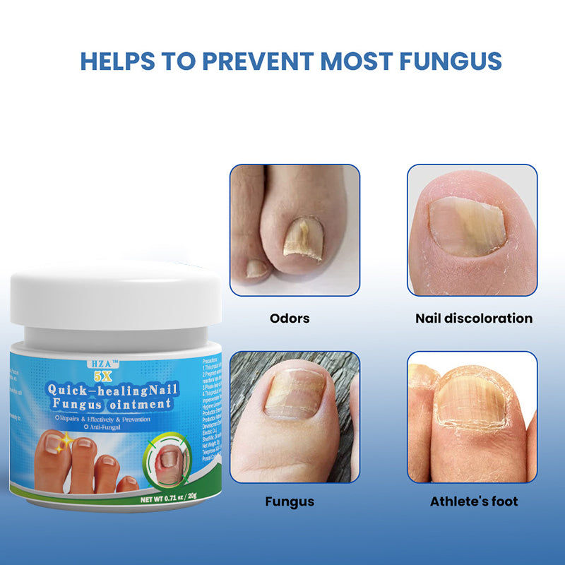 HZA™ 5X Quick-healing Nail Fungus Ointment