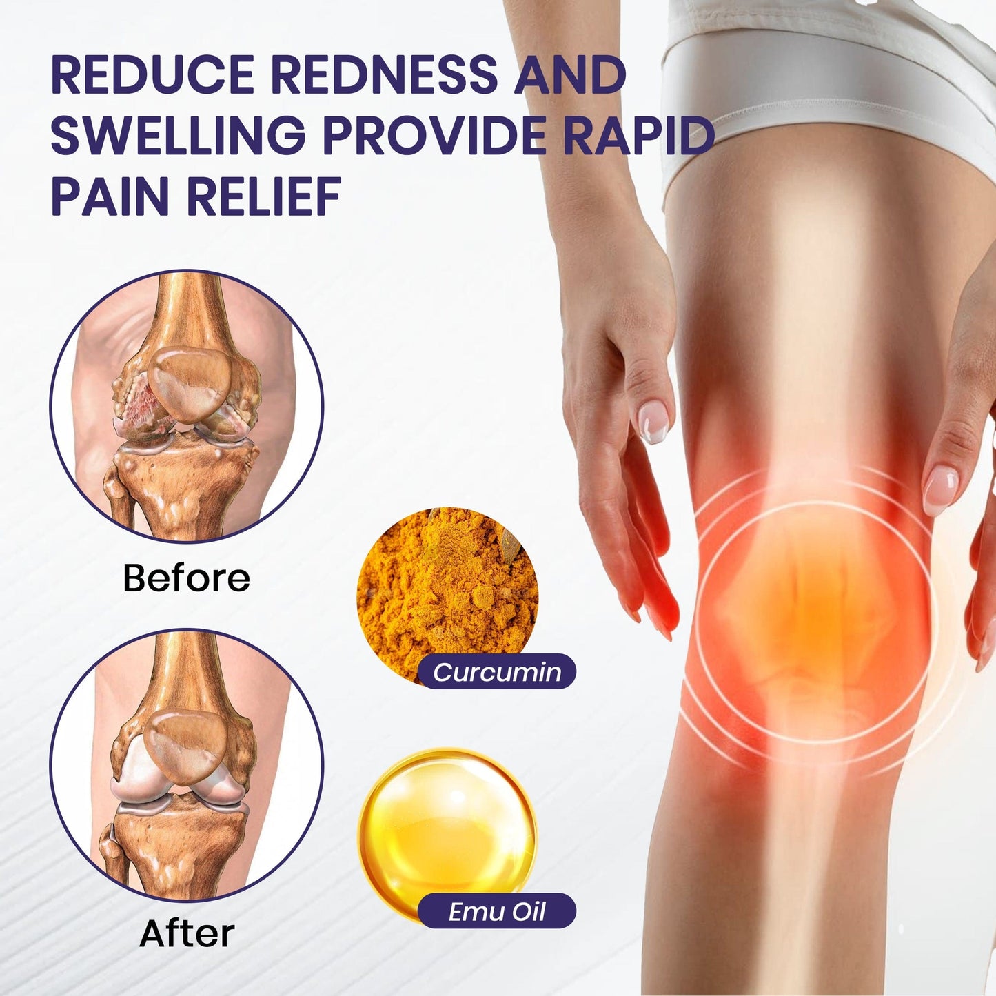 LOVILDS™  Turmeric & Emu Oil Arthritis Soothing Pain Relief Massage Gel