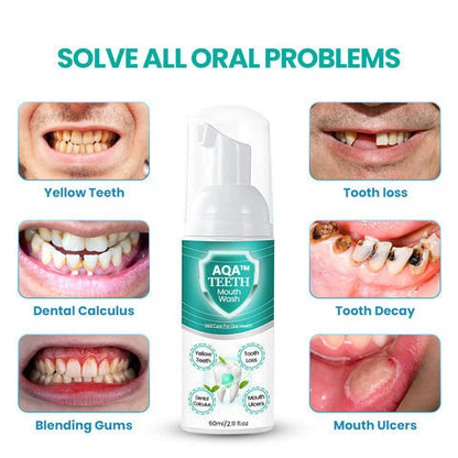 (🔥LAST DAY SALE-80% OFF)AQA™ NEW TEETH Mouthwash - Solve all Oral Problems