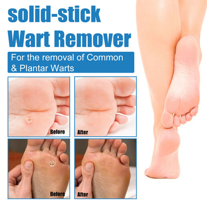HZA ® Warts Remover Stick