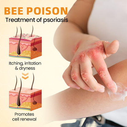 LOVILDS™ Bee Poison Psoriasis Skin Care