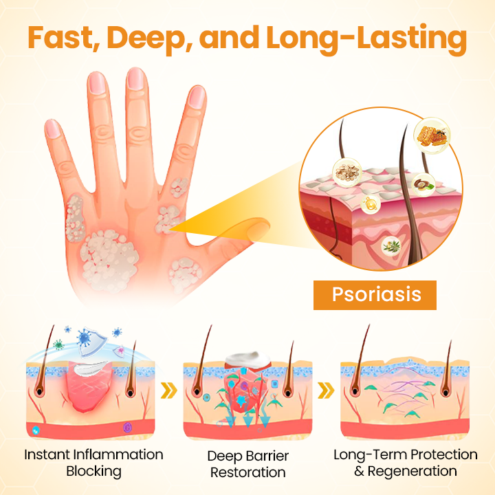 LOVILDS™ Bee Poison Psoriasis Skin Care