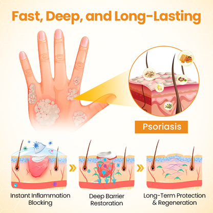 LOVILDS™ Bee Poison Psoriasis Skin Care